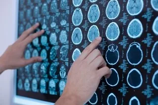 PRATIQUER CE SPORT À HAUT NIVEAU EST DANGEREUX POUR LE CERVEAU, MAIS C’EST PROBABLEMENT PIRE QUE CE QUE NOUS PENSIONS