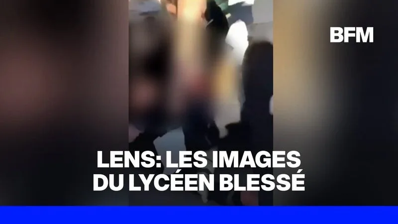 IMAGES SENSIBLES – UN LYCÉEN DE 15 ANS A EU LA MAIN « ARRACHÉE » À LENS, L’IGPN SAISIE