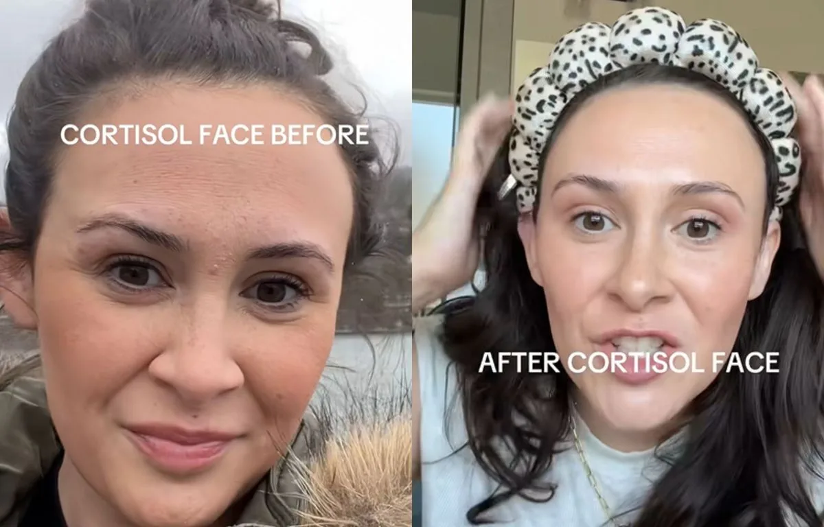 LE « CORTISOL FACE » EST-IL UNE ARNAQUE DES RÉSEAUX SOCIAUX ?
