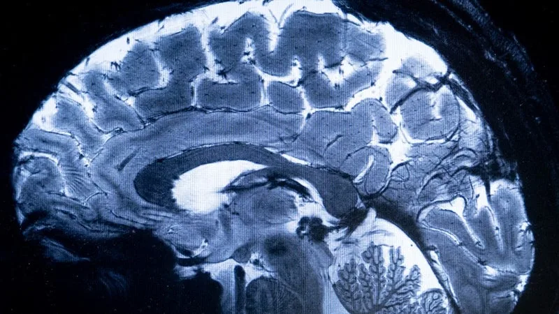 LE CERVEAU HUMAIN EST COMPOSÉ DE DEUX ORGANES DISTINCTS, SELON UNE ÉTUDE MENÉE PAR L’UNIVERSITÉ DE STANFORD
