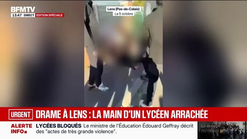 IMAGES SENSIBLES – UN LYCÉEN DE 15 ANS A EU LA MAIN « ARRACHÉE » À LENS, L’IGPN SAISIE